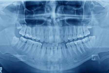 口腔外科で扱う主な治療・疾患