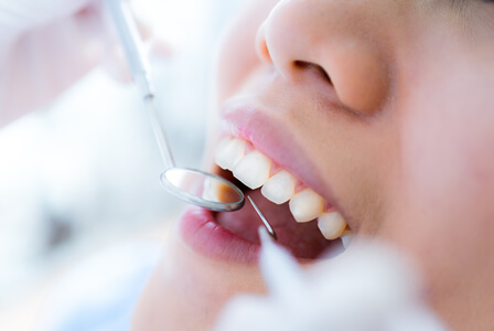 当院の予防歯科